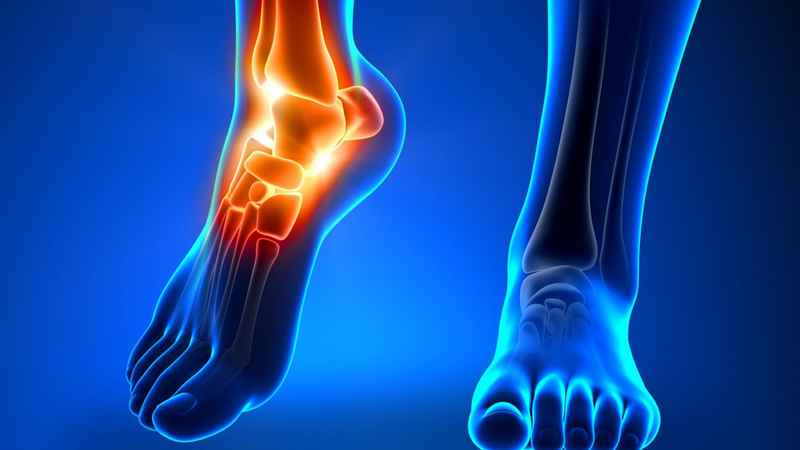 Do you need an ankle joint replacement?